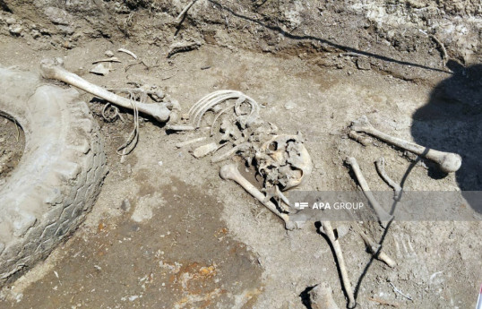 Les restes de 5 autres personnes retrouvés dans la fosse commune à Khodjaly