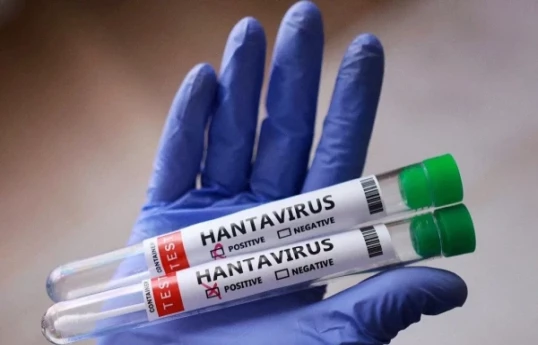 En Azerbaïdjan, il existe une possibilité de dépistage du hantavirus par la méthode PCR, et le risque de propagation de la maladie est faible